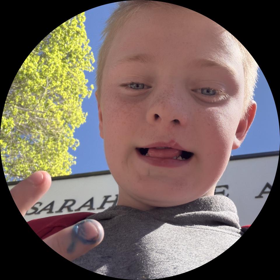 BB