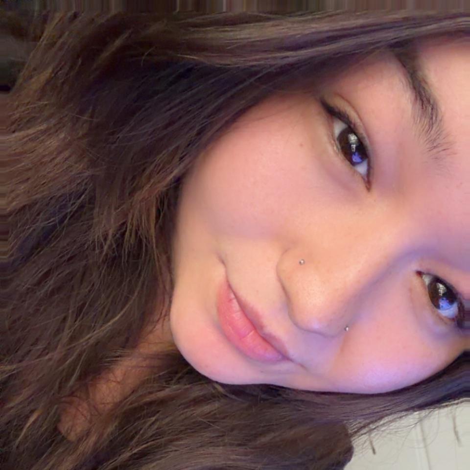 MS