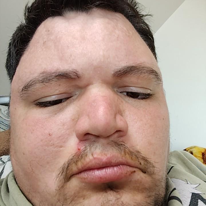 TL